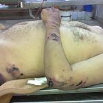 Body of Zlinten man tortured to death dumped in local hospital
