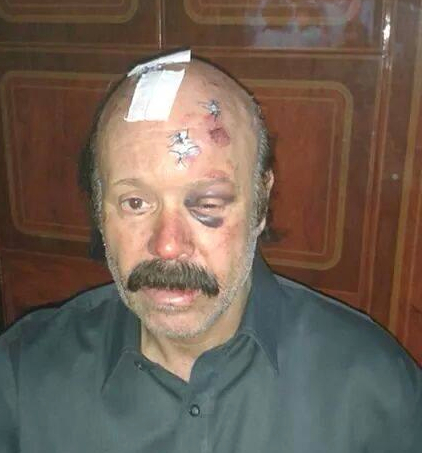 Tripoli university professor beaten up "for refusing to go on TV"