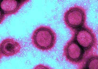 Confirmed death of Tripoli child from H1N1 swine flu